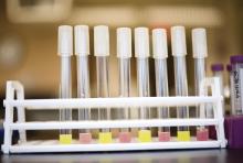 Pipettes