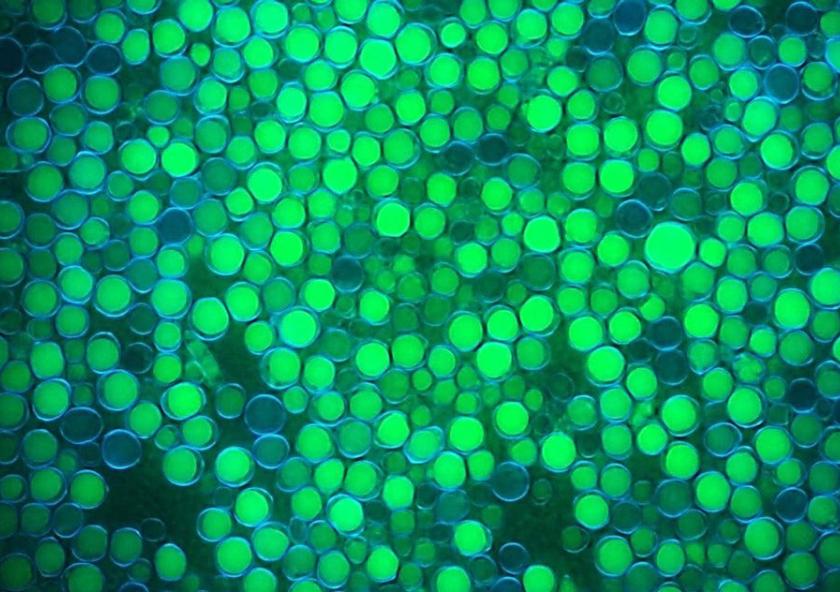 The ability to ferment low-cost feedstocks under nonsterile conditions may enable new classes of biochemicals and biofuels, such as microbial oil produced by the yeast Yarrowia lipolytica (shown here, oil in lipid bodies is stained green and cell... The ability to ferment low-cost feedstocks under nonsterile conditions may enable new classes of biochemicals and biofuels, such as microbial oil produced by the yeast Yarrowia lipolytica (shown here, oil in lipid bodies is stained green and cell...
