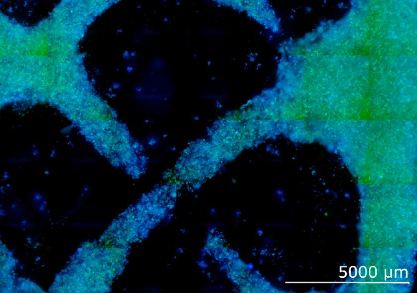 MIT researchers have proposed a method to grow plant-based materials, like wood and fiber, and have demonstrated the concept by growing a culture of wood-like cells from zinnia leaves, pictured.
Image courtesy of th...
MIT researchers have proposed a method to grow plant-based materials, like wood and fiber, and have demonstrated the concept by growing a culture of wood-like cells from zinnia leaves, pictured.
Image courtesy of th...