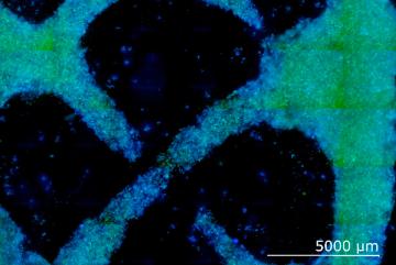 
              MIT researchers have proposed a method to grow plant-based materials, like wood and fiber, and have demonstrated the concept by growing a culture of wood-like cells from zinnia leaves, pictured.
              Image courtesy of th...